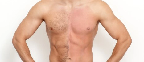 Chiropractic Springfield VA Hair Removal Chest