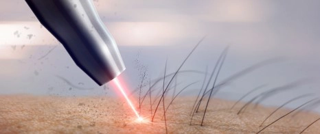 Chiropractic Springfield VA Laser Hair Removal